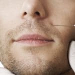 The Most Popular Facial Surgeries for Men and Why