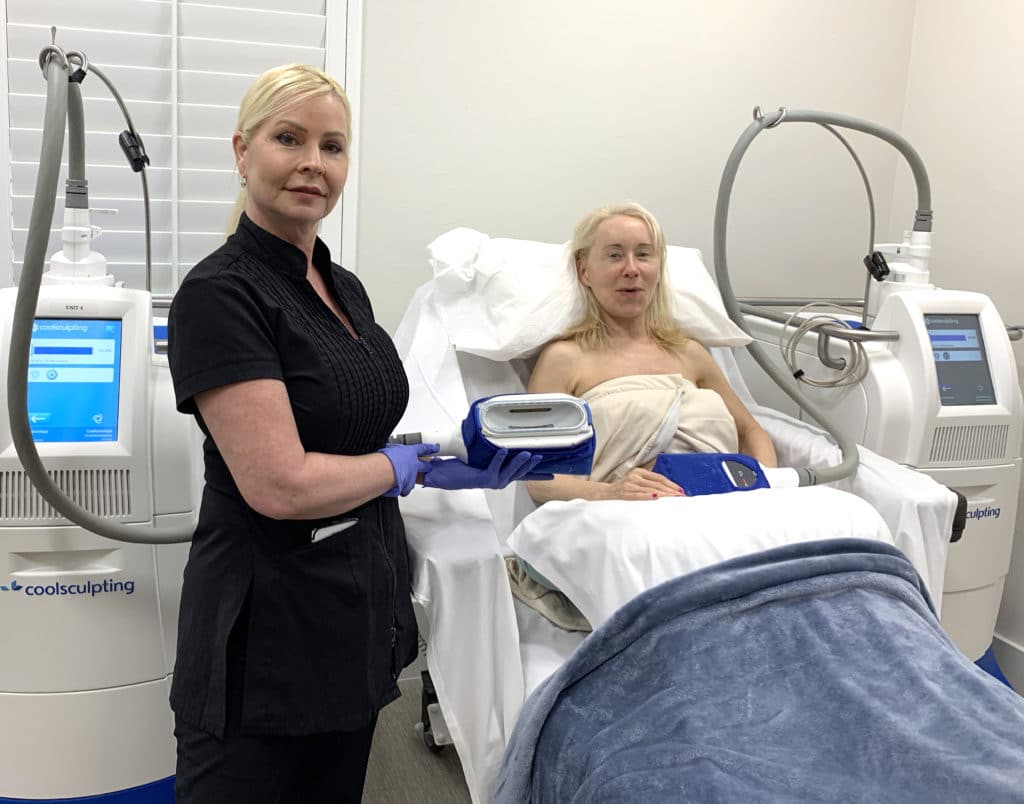 lisa coolsculpting1