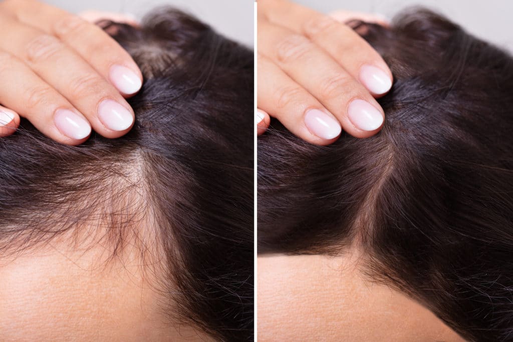 bigstock woman before and after hair lo 317334385