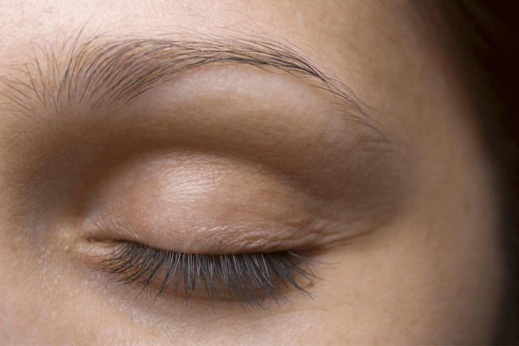 Eyelid Expert