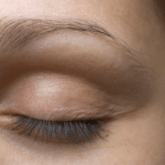 Sept. Eyelid Expert
