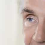 Eyelid Surgery