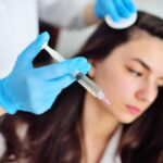 plasma treatment plasmolifting prp method point